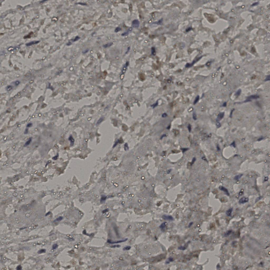 slice_23_28_x20608_y25088.png