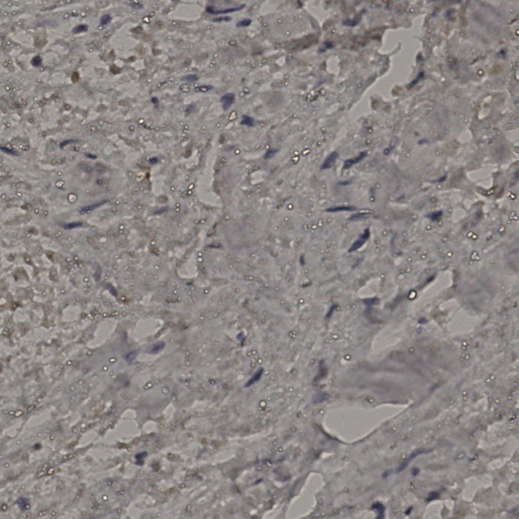 slice_23_29_x20608_y25984.png