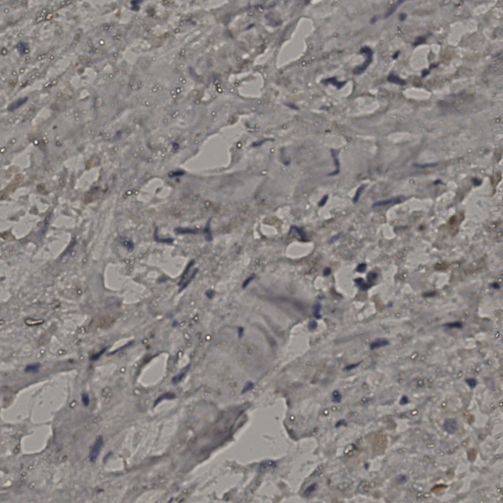 slice_23_30_x20608_y26880.png