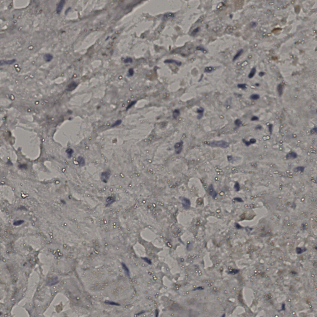 slice_23_31_x20608_y27776.png