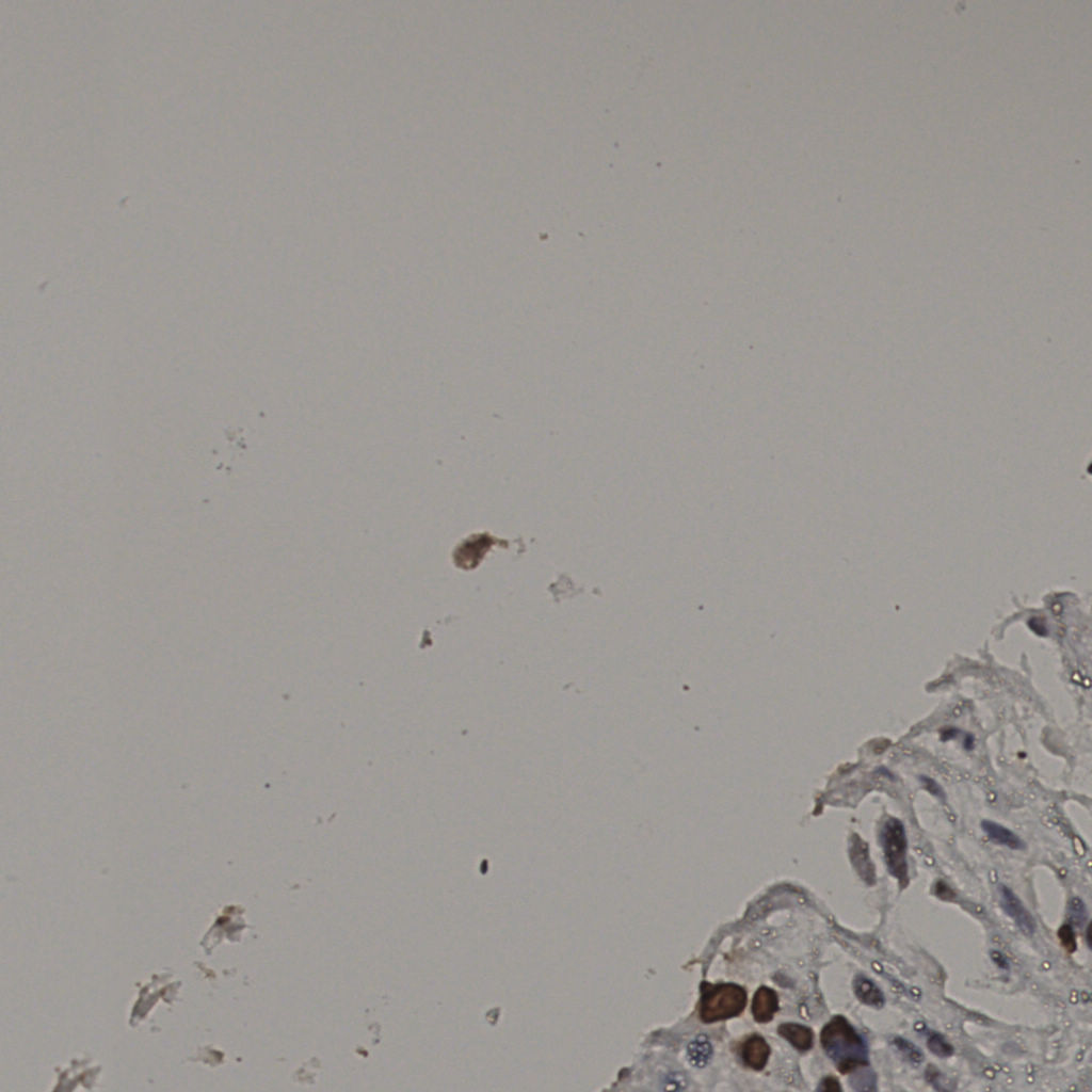 slice_24_23_x21504_y20608.png