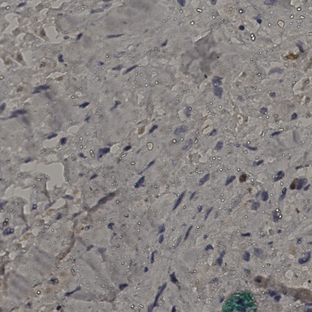 slice_24_28_x21504_y25088.png