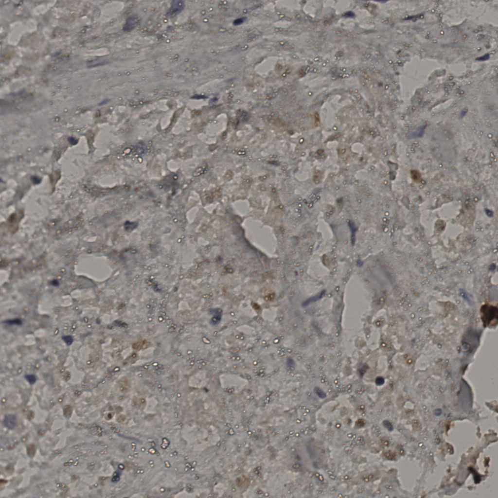 slice_24_30_x21504_y26880.png