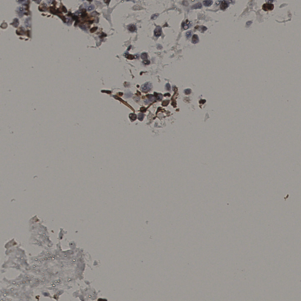 slice_24_37_x21504_y33152.png