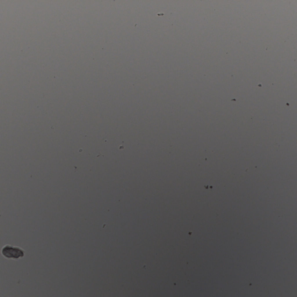 slice_25_20_x22400_y17920.png