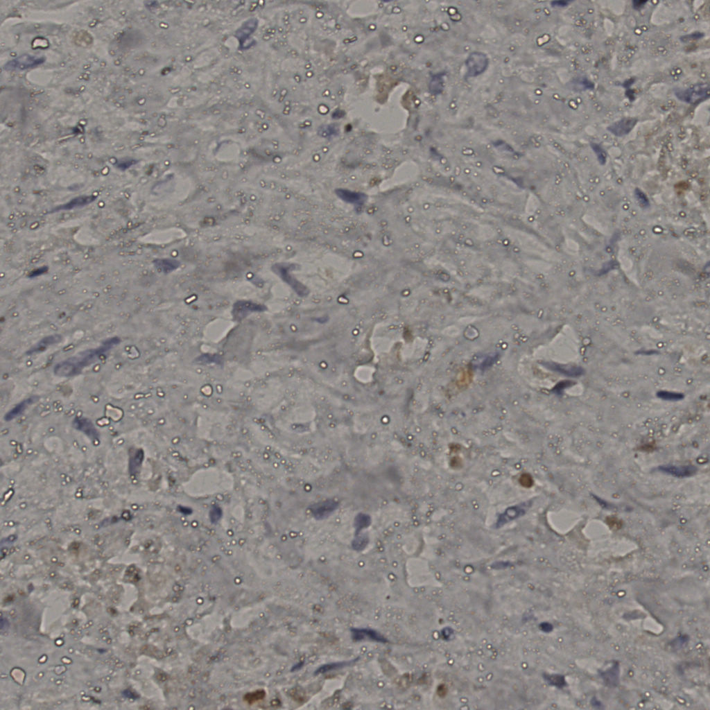 slice_25_27_x22400_y24192.png