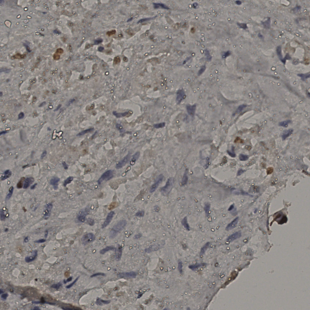 slice_25_28_x22400_y25088.png