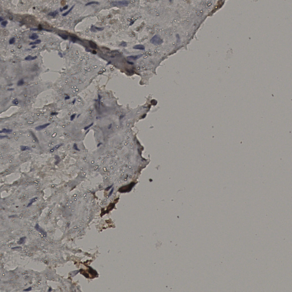 slice_25_29_x22400_y25984.png