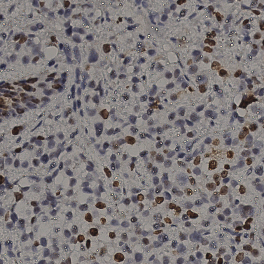 slice_25_34_x22400_y30464.png