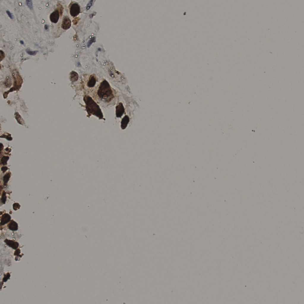 slice_25_47_x22400_y42112.png