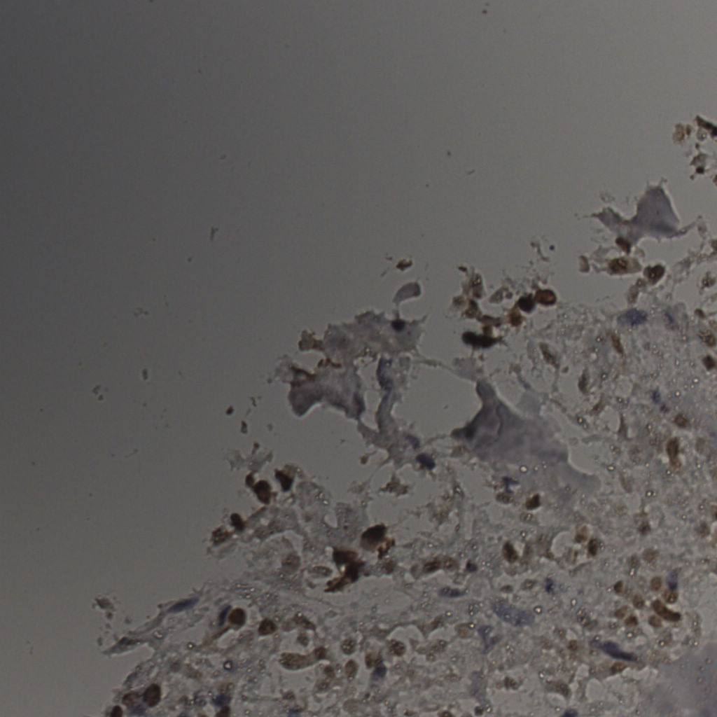 slice_26_21_x23296_y18816.png