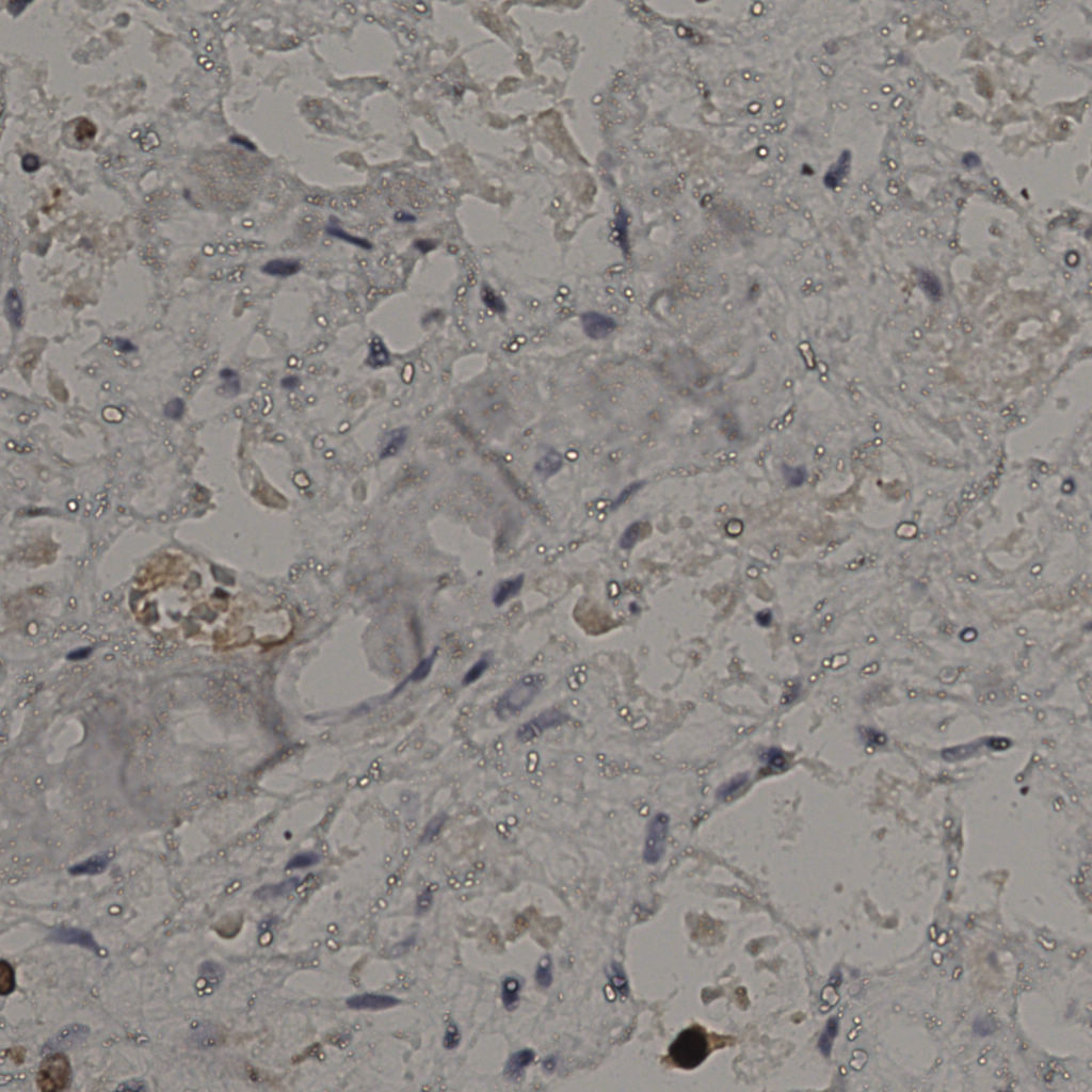 slice_26_39_x23296_y34944.png