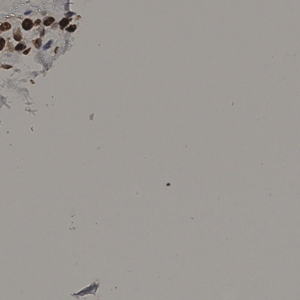 slice_26_45_x23296_y40320.png