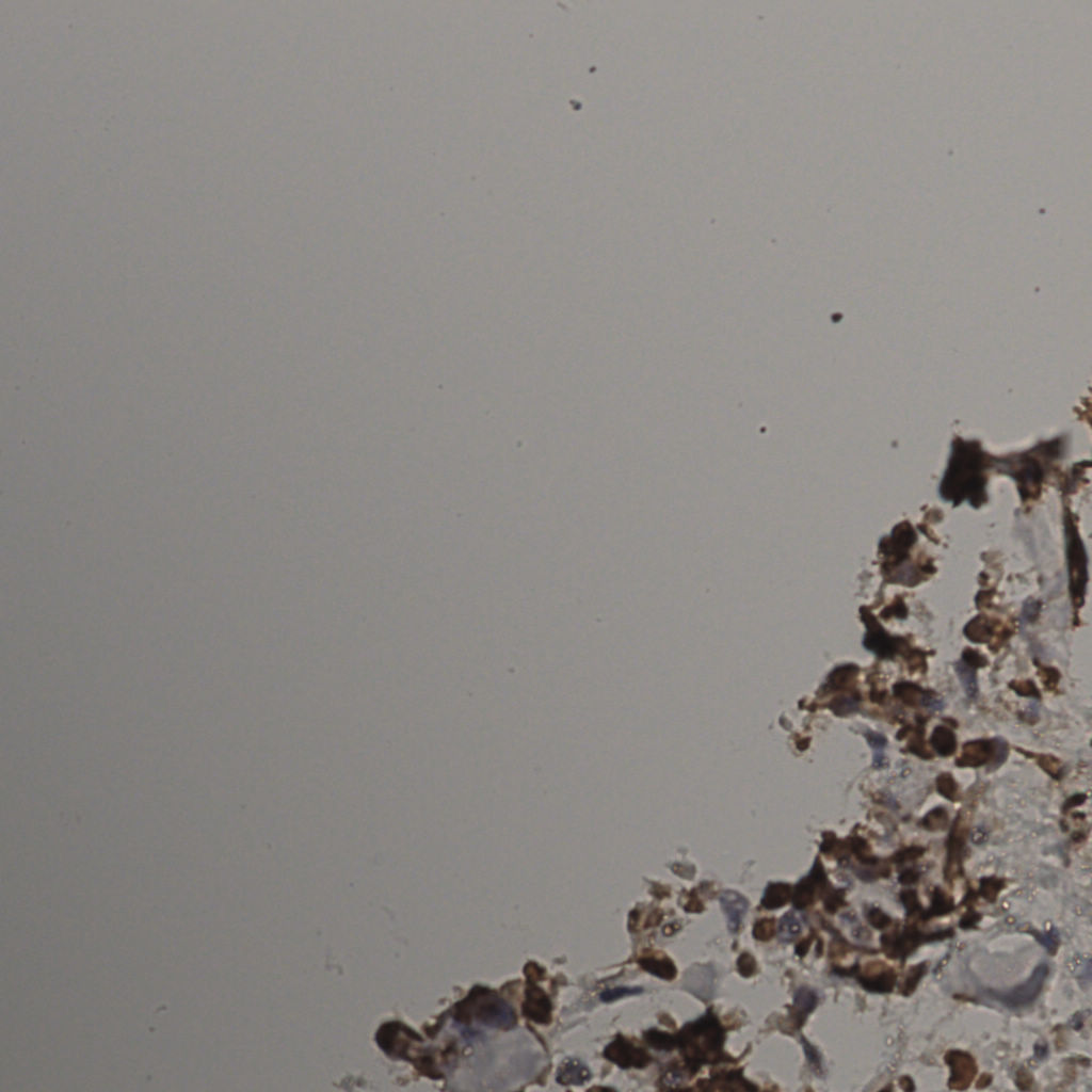 slice_27_20_x24192_y17920.png