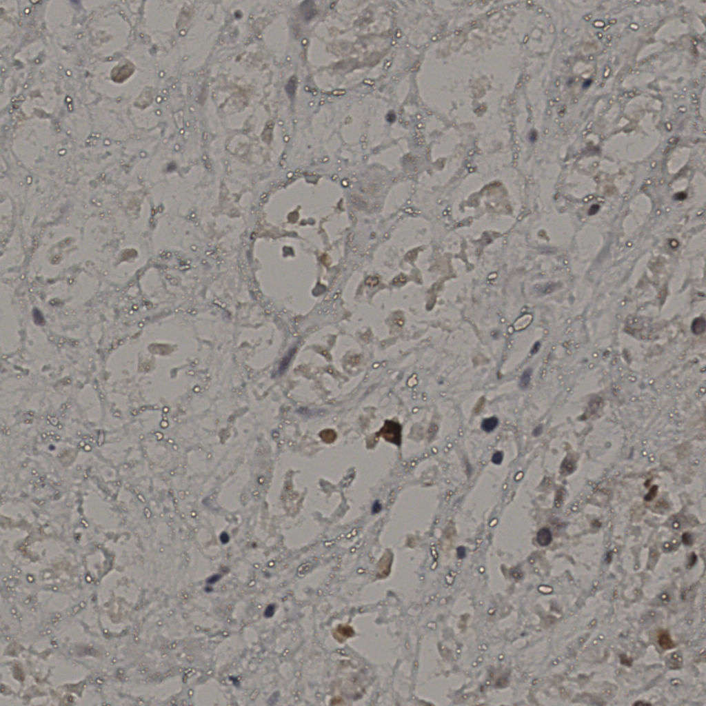 slice_27_38_x24192_y34048.png