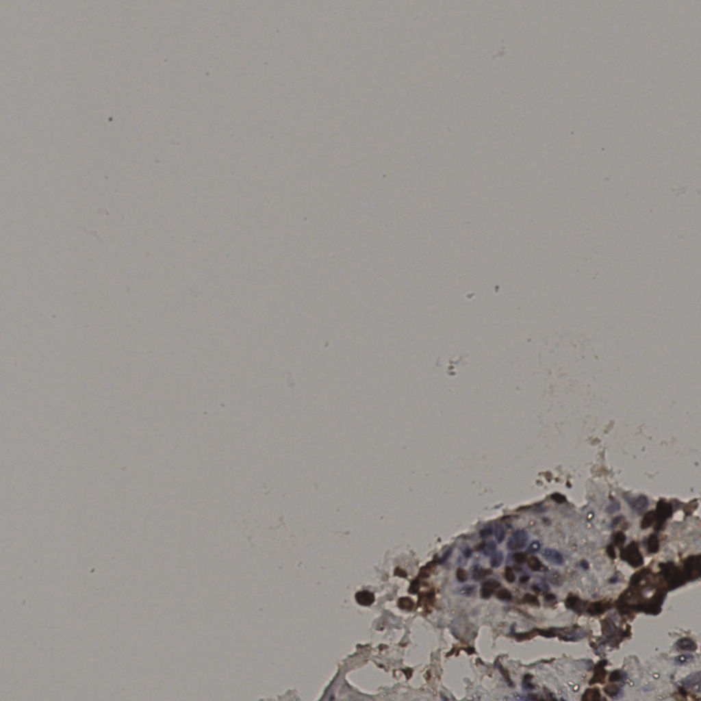 slice_28_19_x25088_y17024.png