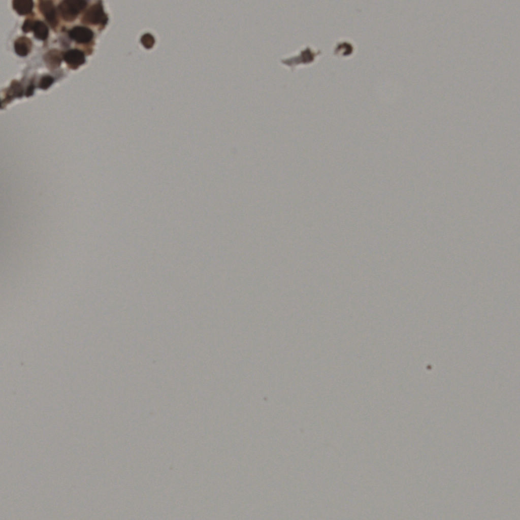 slice_2_6_x1792_y5376.png