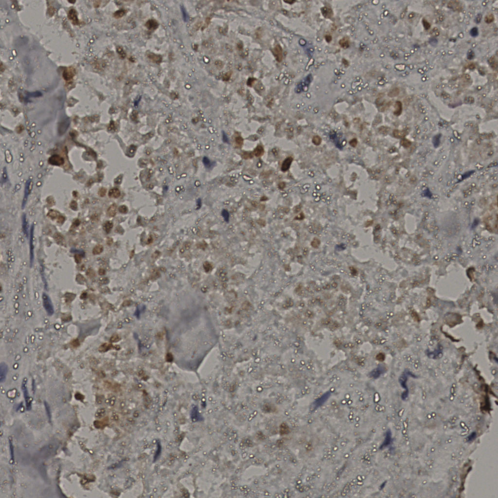 slice_30_23_x26880_y20608.png