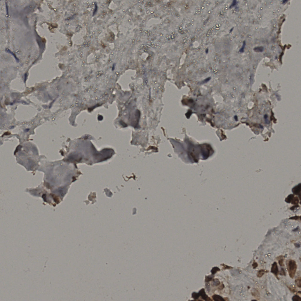 slice_30_24_x26880_y21504.png