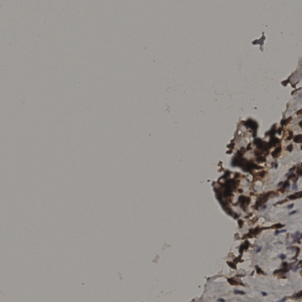 slice_31_16_x27776_y14336.png