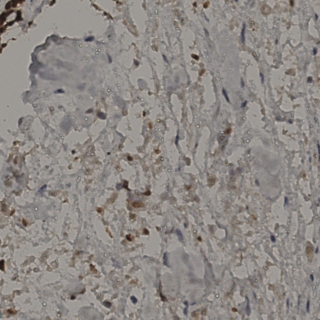slice_31_30_x27776_y26880.png