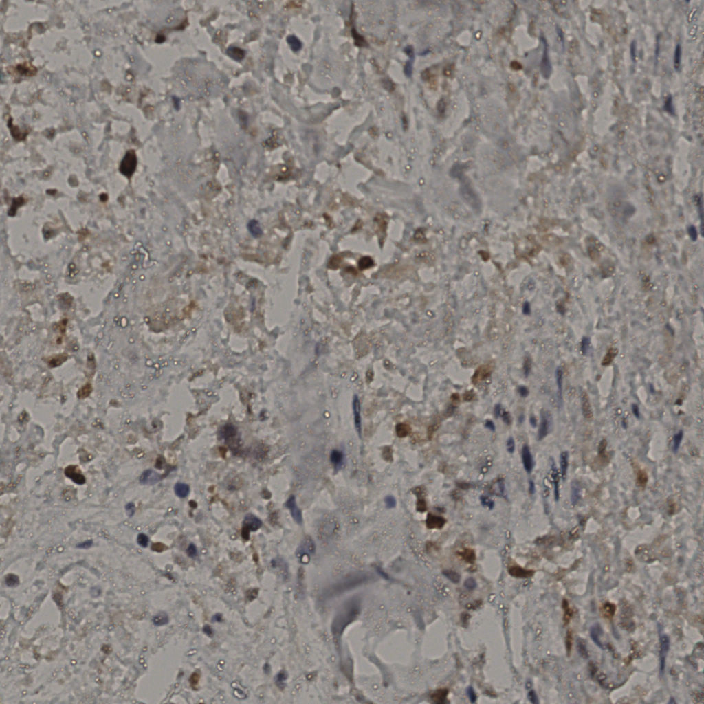slice_31_31_x27776_y27776.png