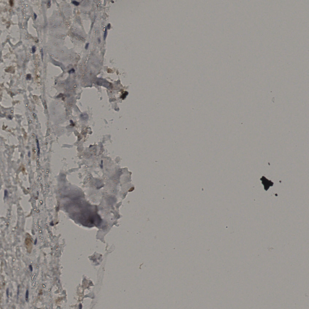 slice_32_30_x28672_y26880.png