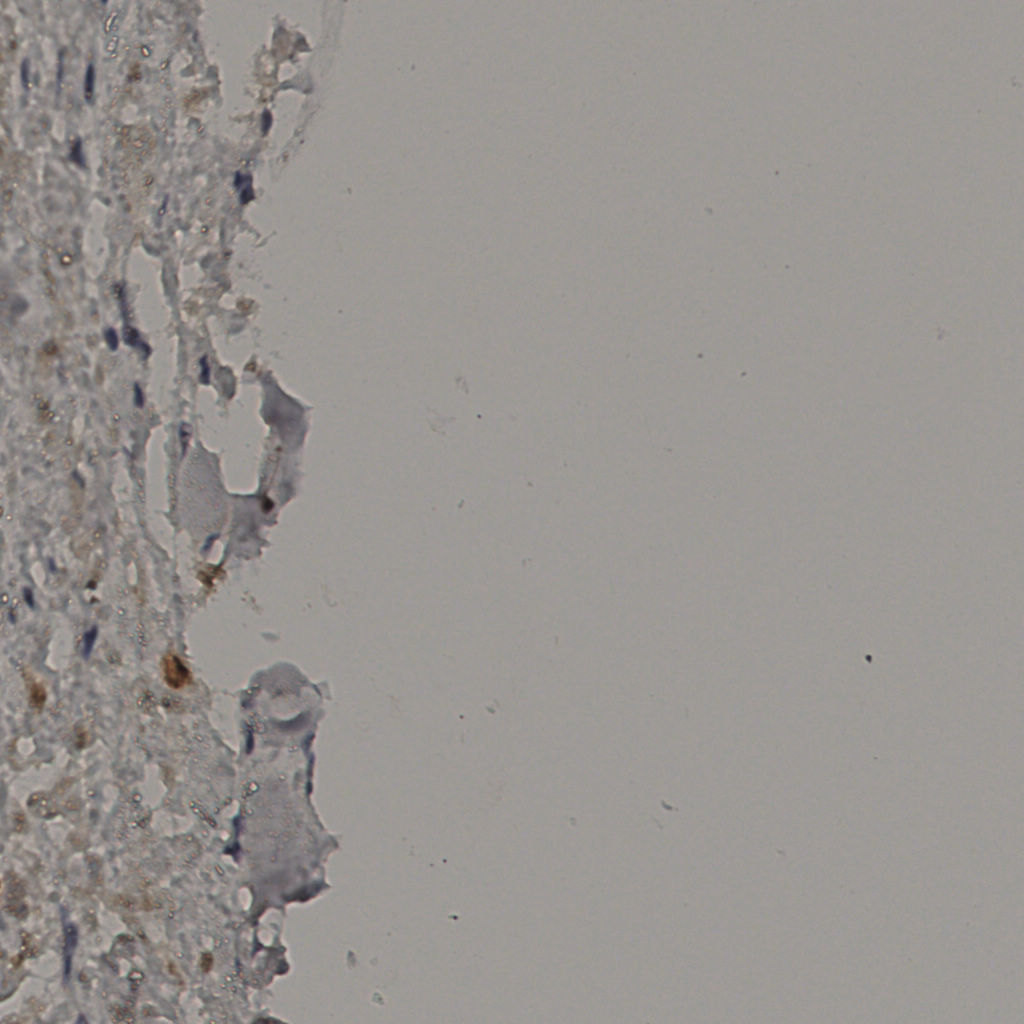 slice_32_31_x28672_y27776.png