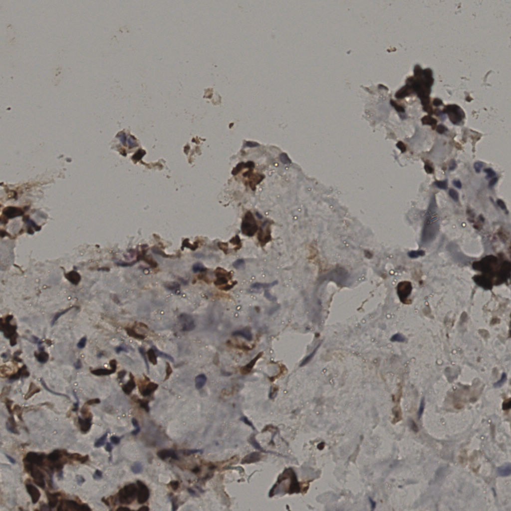 slice_33_13_x29568_y11648.png