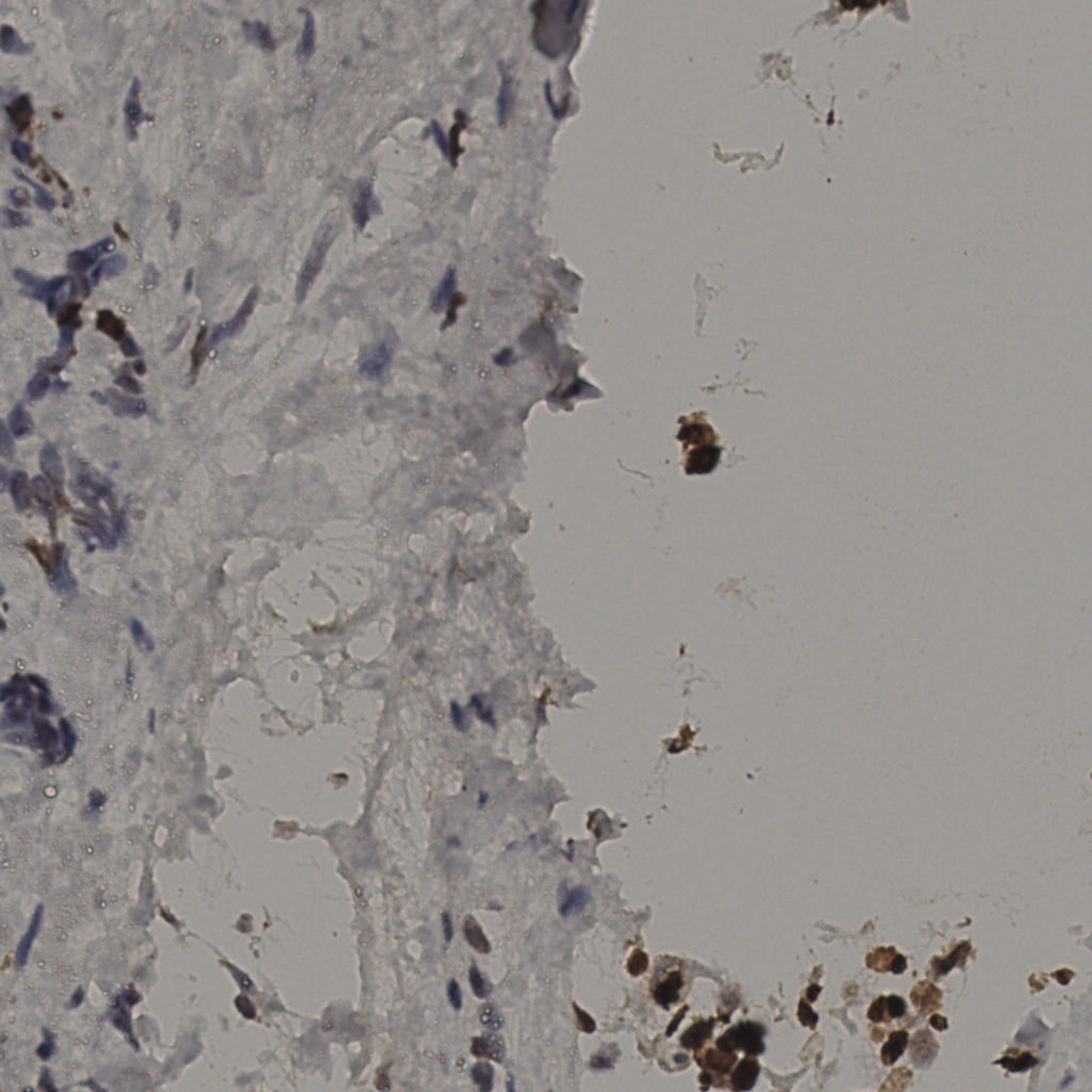 slice_33_17_x29568_y15232.png