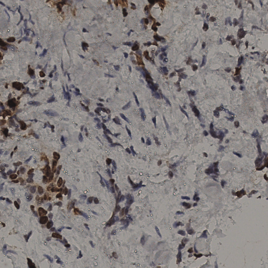 slice_33_20_x29568_y17920.png