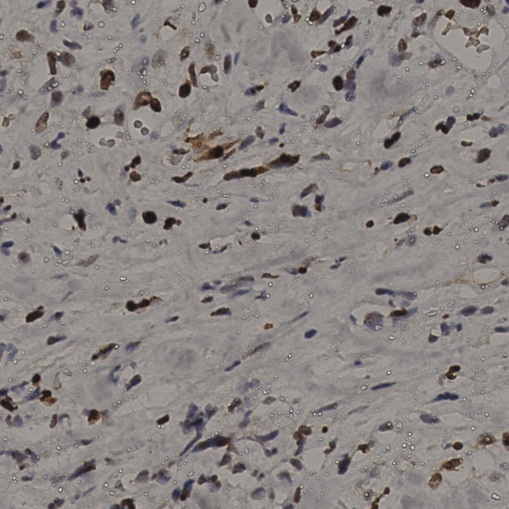 slice_33_23_x29568_y20608.png
