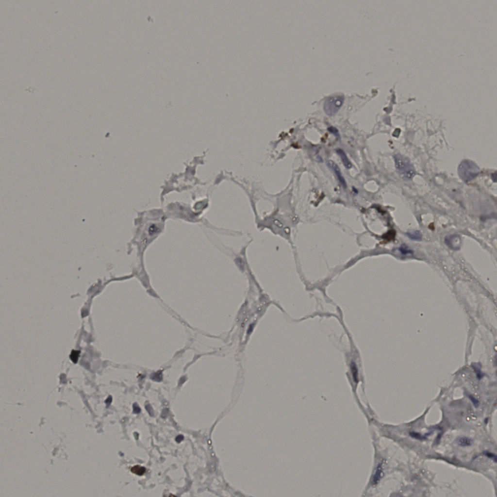 slice_33_7_x29568_y6272.png
