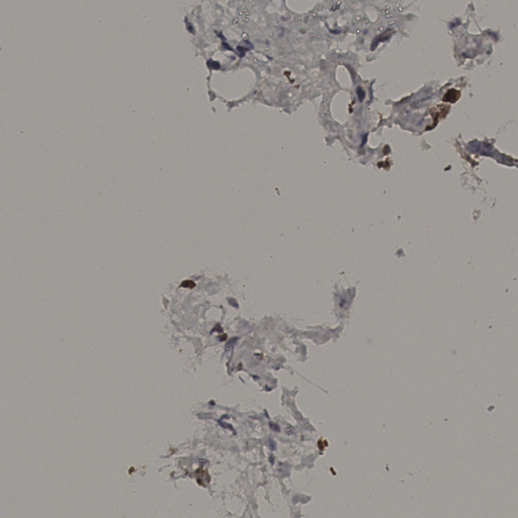 slice_33_9_x29568_y8064.png