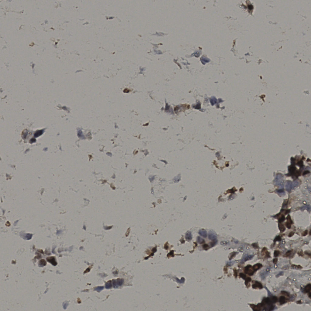 slice_34_12_x30464_y10752.png