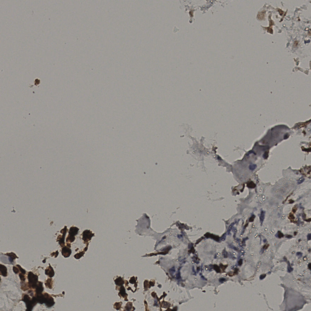slice_34_15_x30464_y13440.png
