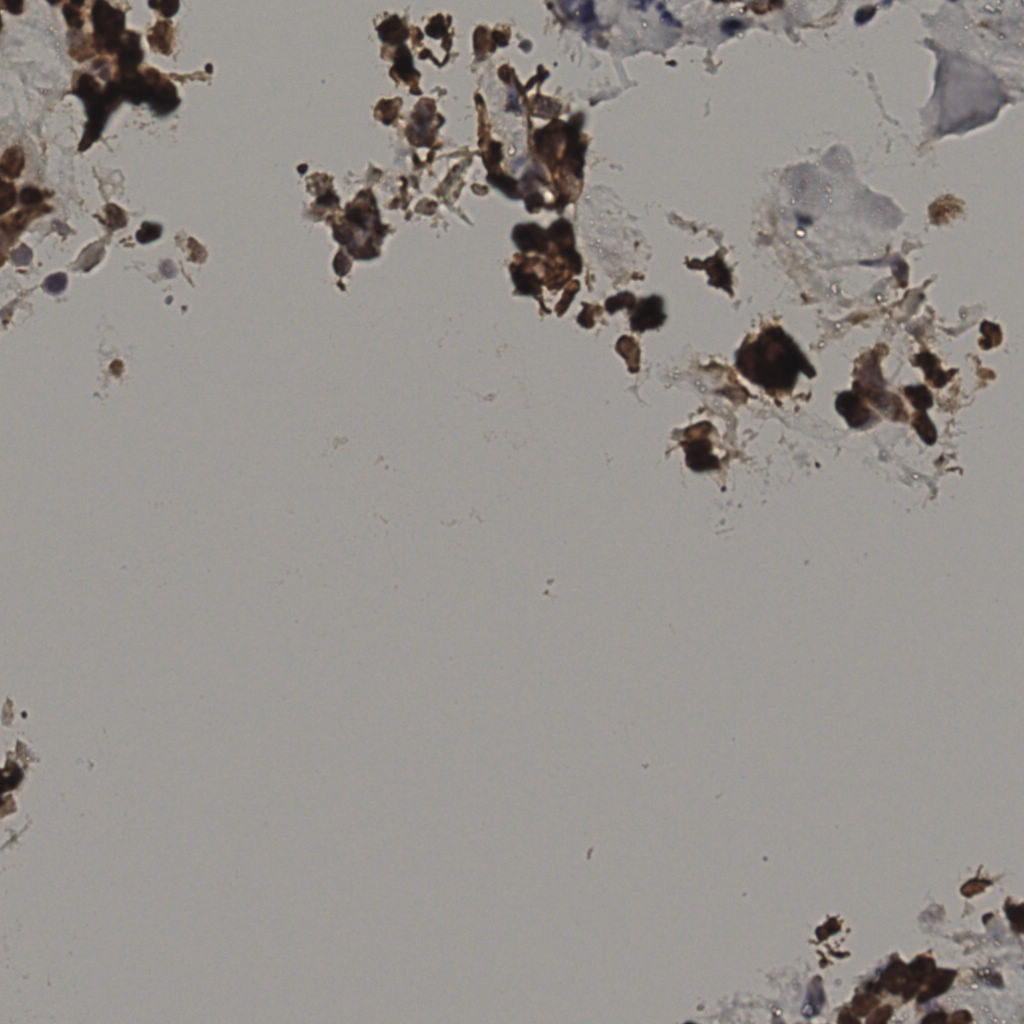 slice_34_16_x30464_y14336.png