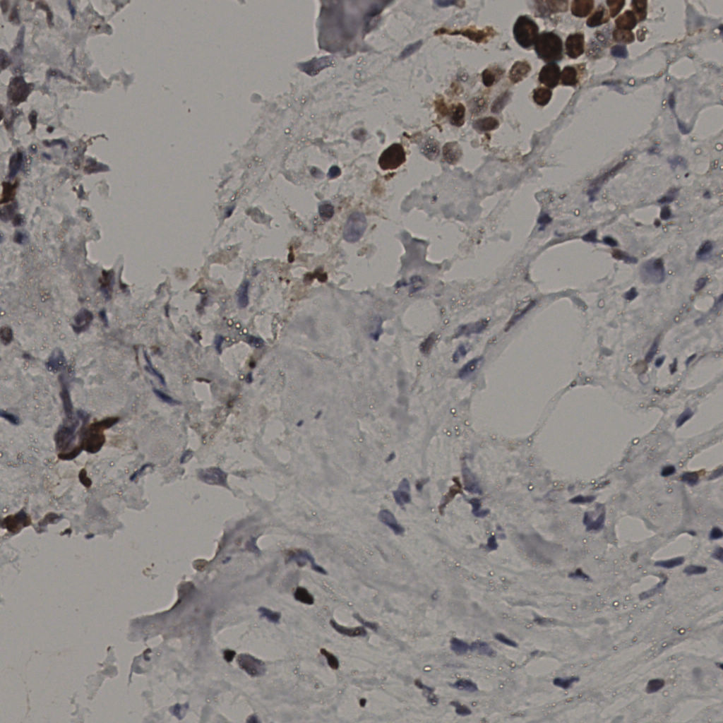 slice_34_20_x30464_y17920.png
