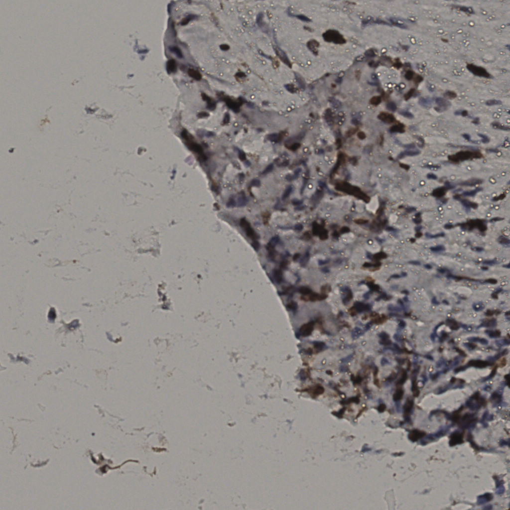 slice_35_10_x31360_y8960.png
