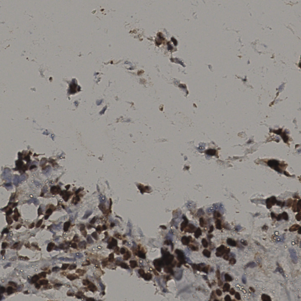 slice_35_12_x31360_y10752.png
