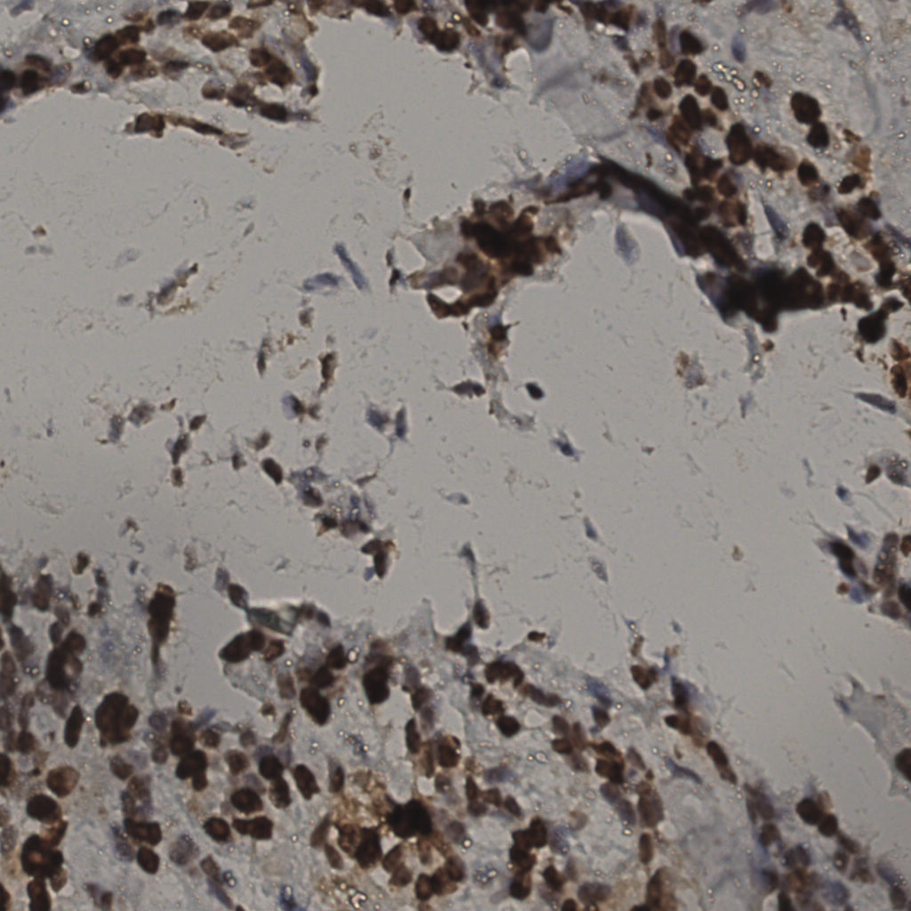 slice_35_13_x31360_y11648.png