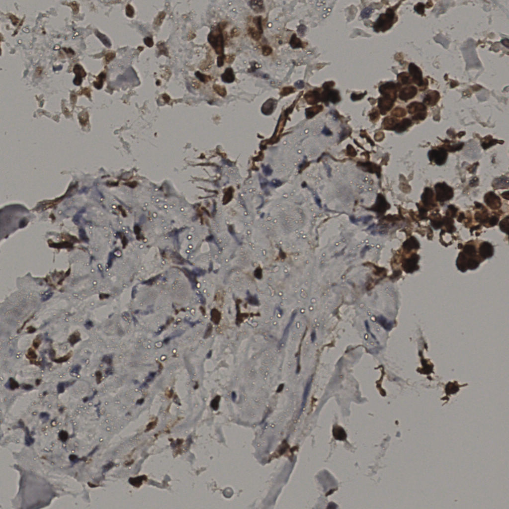 slice_35_15_x31360_y13440.png