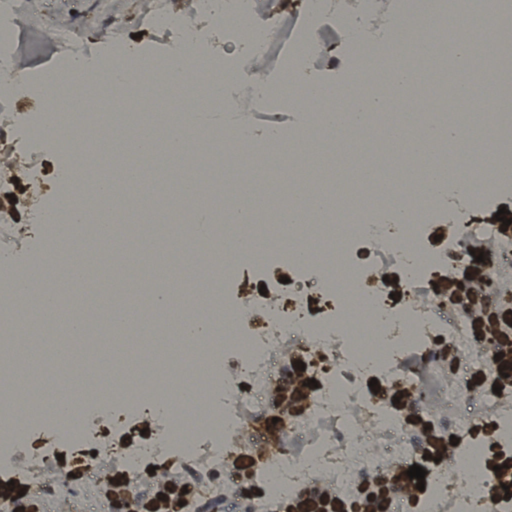 slice_35_16_x31360_y14336.png