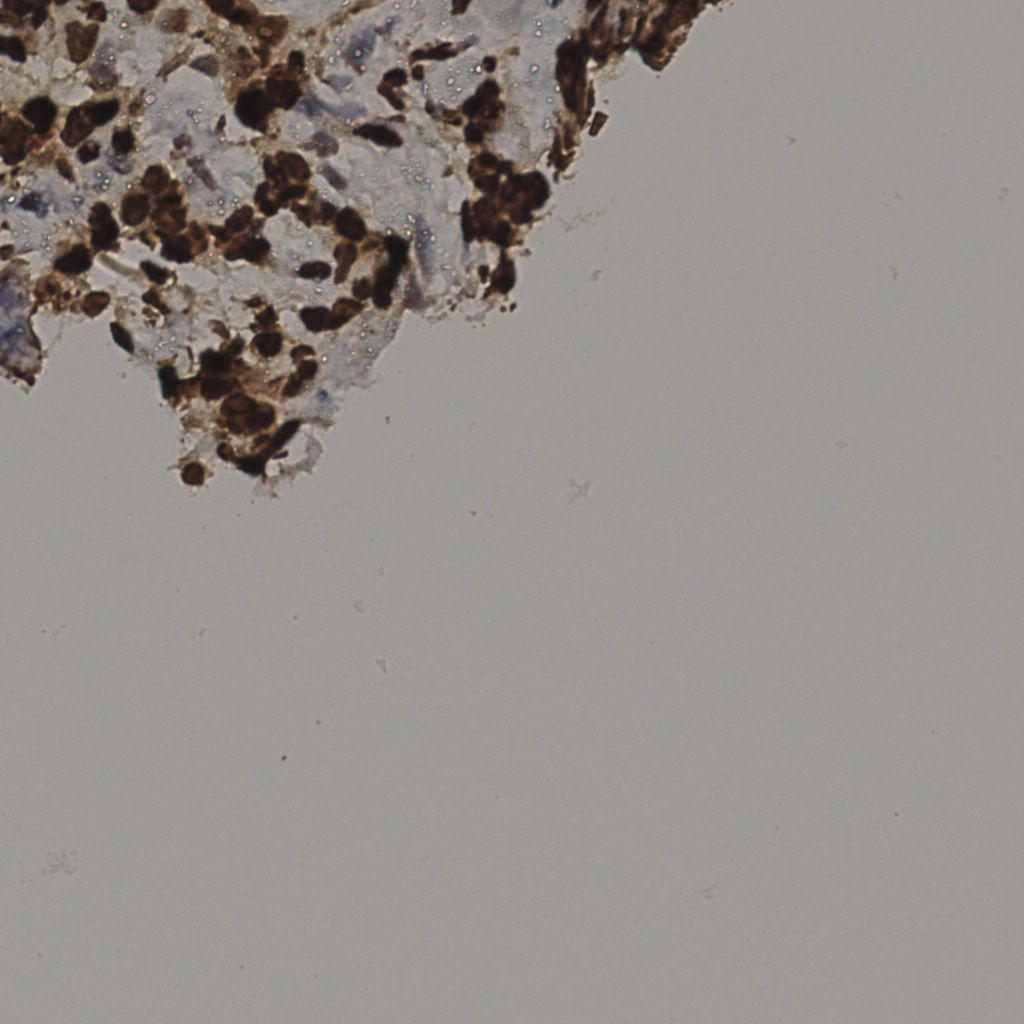 slice_35_26_x31360_y23296.png
