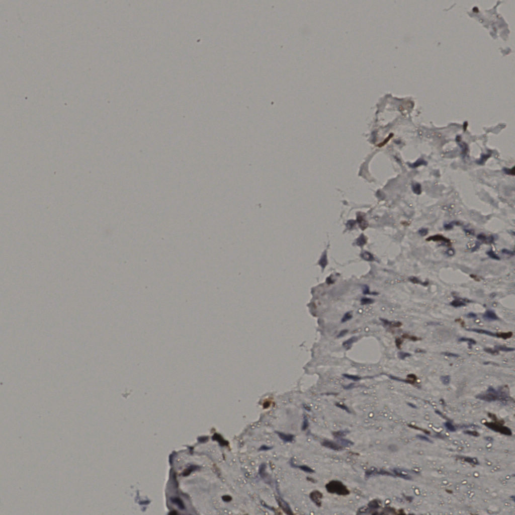 slice_35_9_x31360_y8064.png
