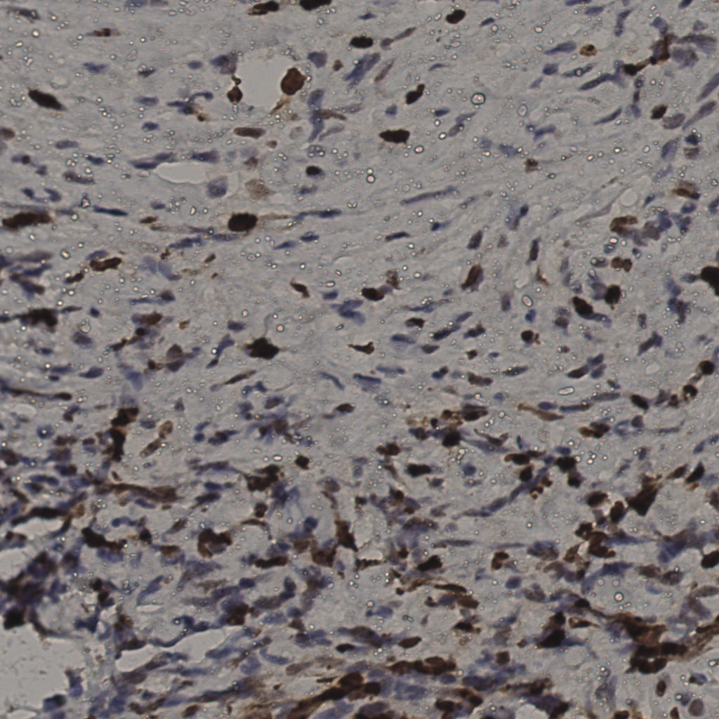 slice_36_10_x32256_y8960.png