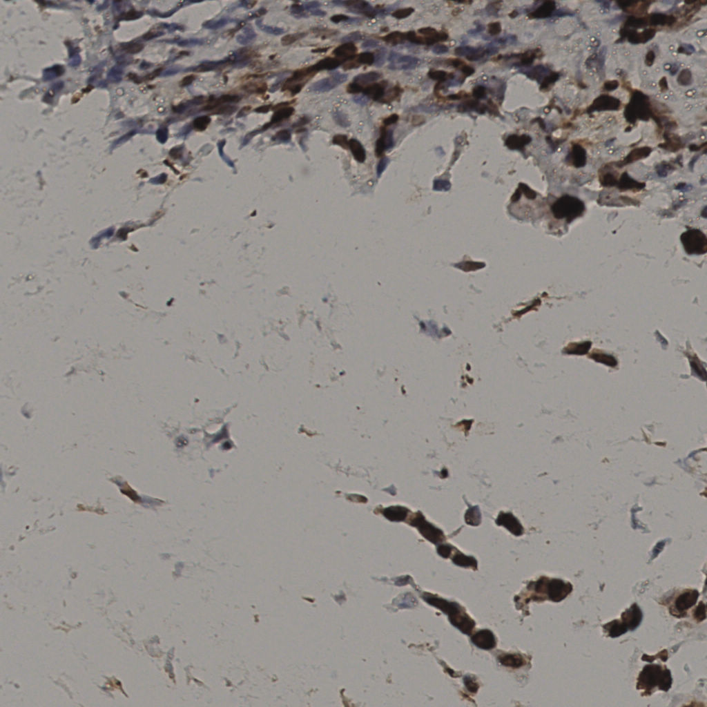 slice_36_11_x32256_y9856.png