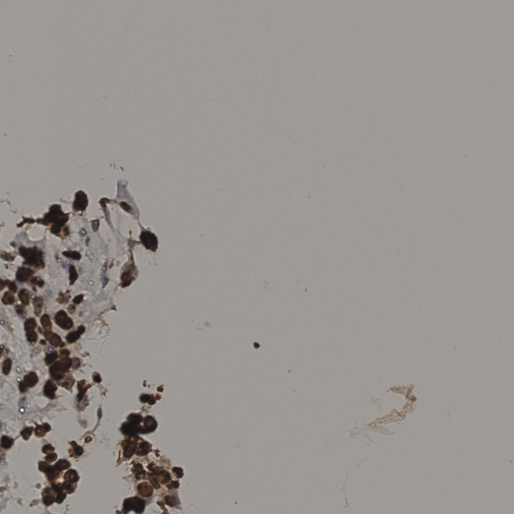 slice_36_16_x32256_y14336.png