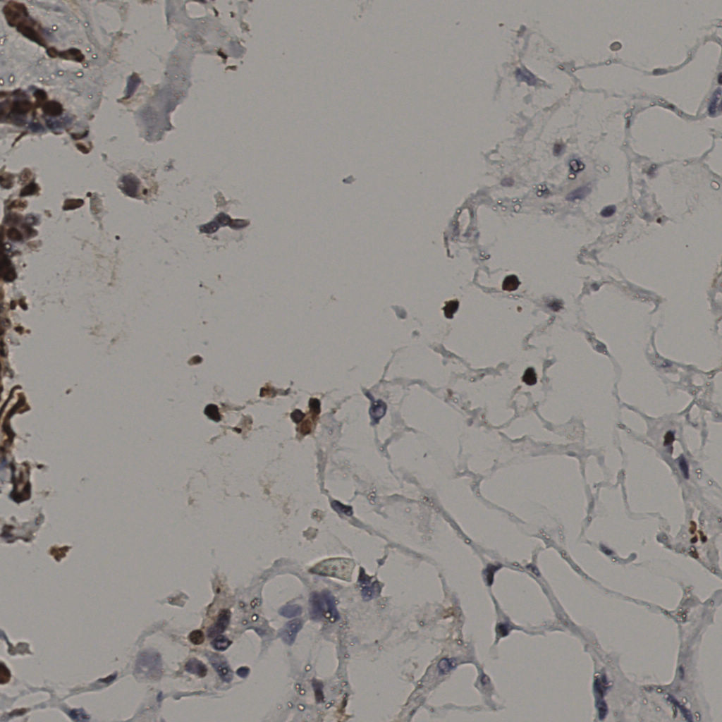 slice_36_18_x32256_y16128.png