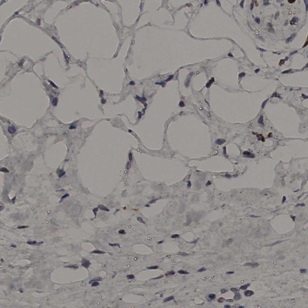 slice_36_20_x32256_y17920.png